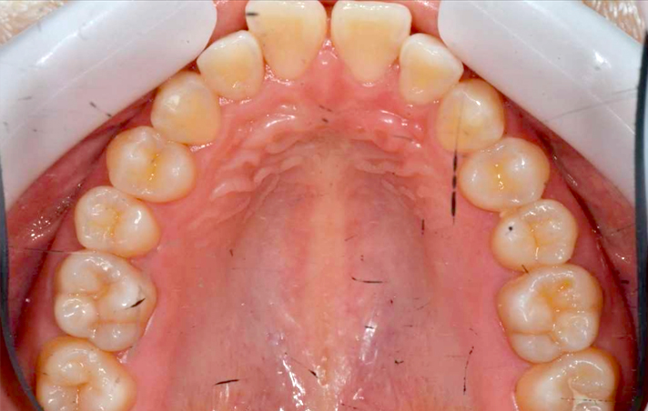 矯正歯科の症例